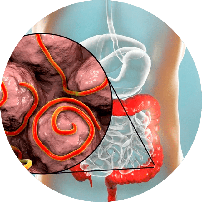 Gastrointestinálny trakt a parazity