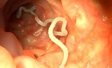 Príčiny parazitov v ľudskom tele